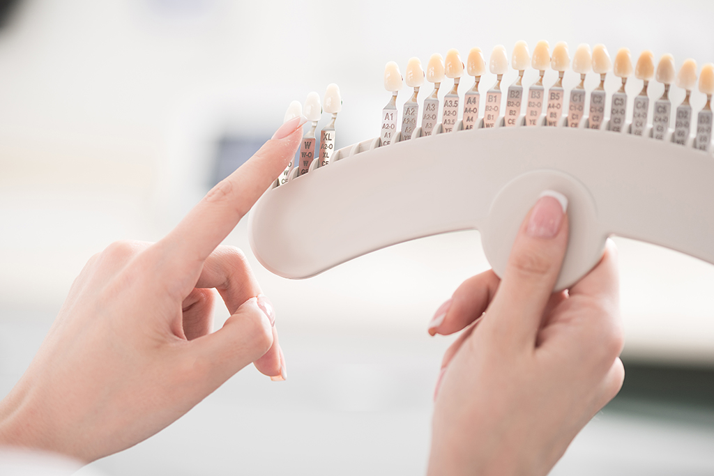 ホワイトニング